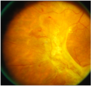 eye retina specialists